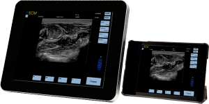 Echographe EXAPAD ECM/ Elite Medicale Promokine