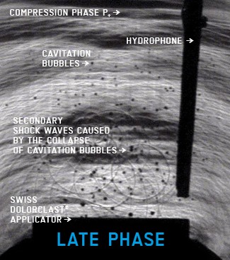 Cavitation sur ondes de choc ems-swiss-dolorclast